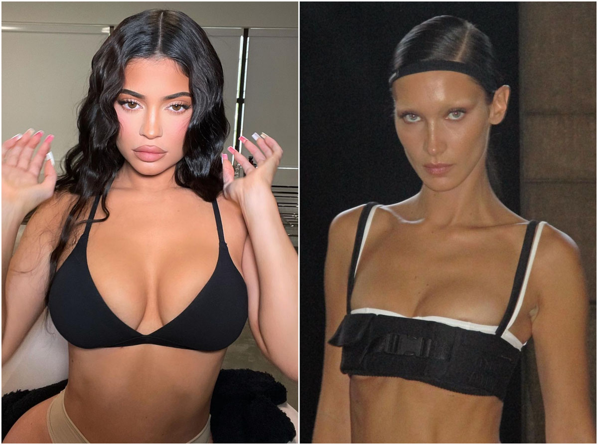 people-get-fillers-dissolved-as-the-baby-faced-look-goes-out-of-fashion