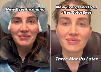 ‘eye-tattooing’-to-change-eye-color-is-trending-but-ophthalmologists-warn-against-it